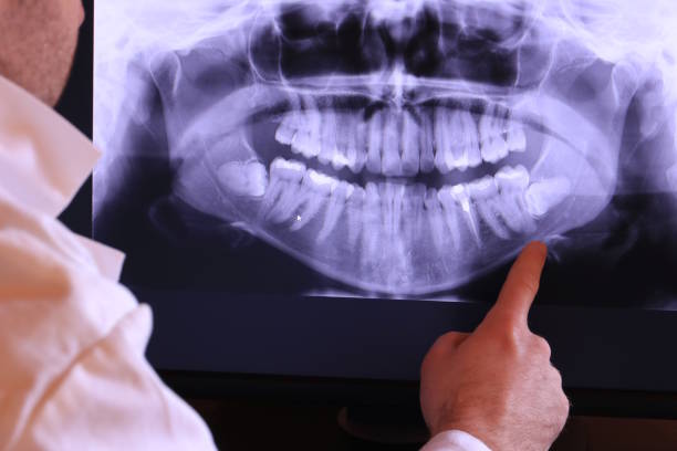 Best Emergency Treatment for Toothache in Lawrenceburg, IN